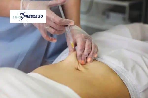 How Does Aqualyx Fat Dissolving Injection Work to Break Down Fat Clifton?