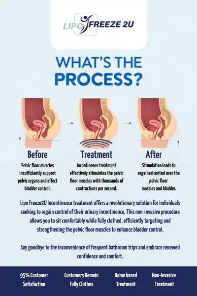Diagram of how incontinence treatment Clifton works.