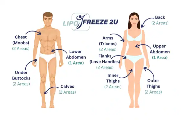 Areas you can have fat freezing treatment Clifton