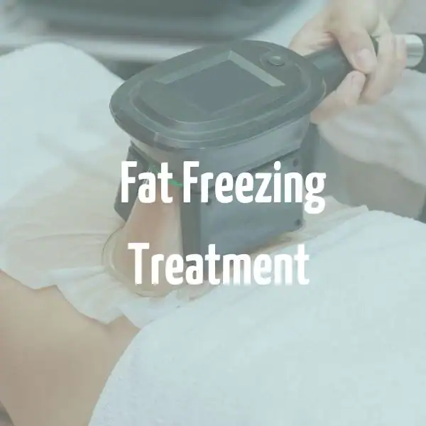 fat freezing treatment Clifton