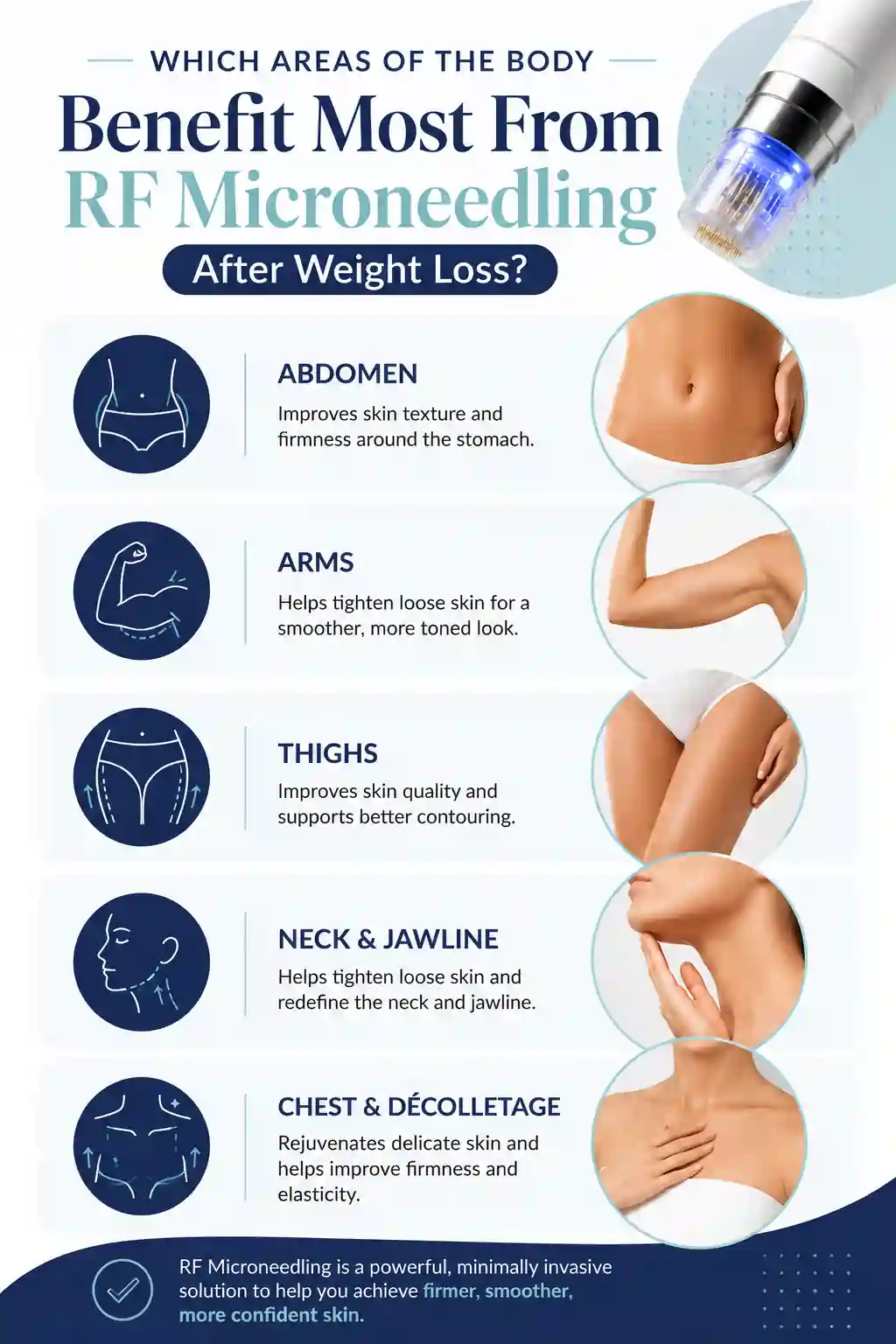 Which Areas of the Body Benefit Most From RF Microneedling After Weight Loss Clifton